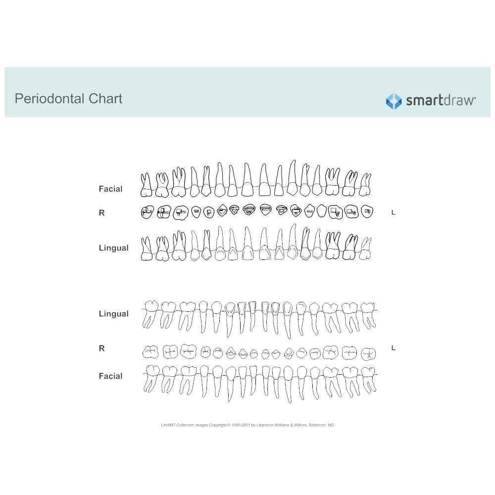 periodontal-chart